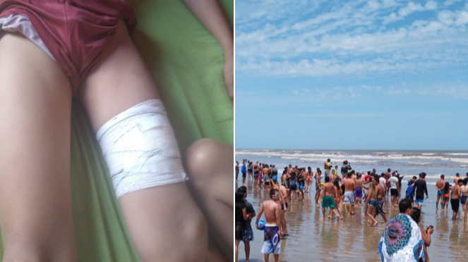 Criança de 11 anos é ferida por tubarão em praia de São Paulo 