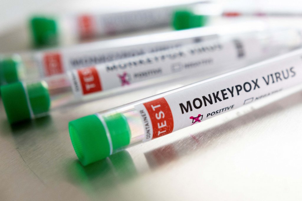 OMS contabiliza 92 casos da varíola dos macacos e diz esperar mais nos próximos dias