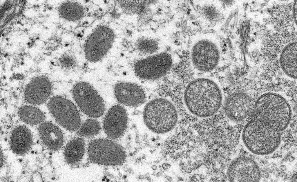 Varíola dos macacos: OMS anuncia resposta unificada contra doença