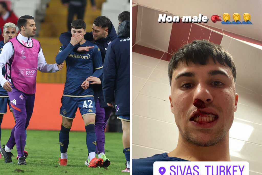 Torcedor invade o gramado e dá soco na cara de jogador da Fiorentina na Conference League
