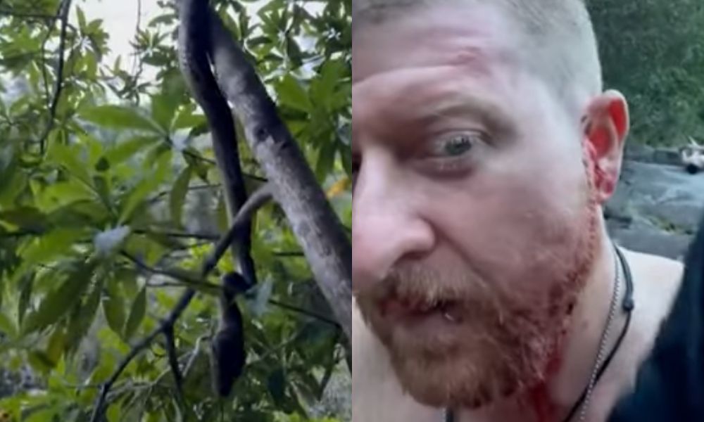 Australiano tenta gravar cobra de perto e é mordido no rosto: ‘Loucura a quantidade de sangue’