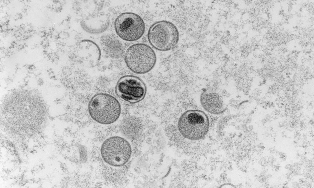 Califórnia declara estado de emergência em meio ao surto de varíola dos macacos