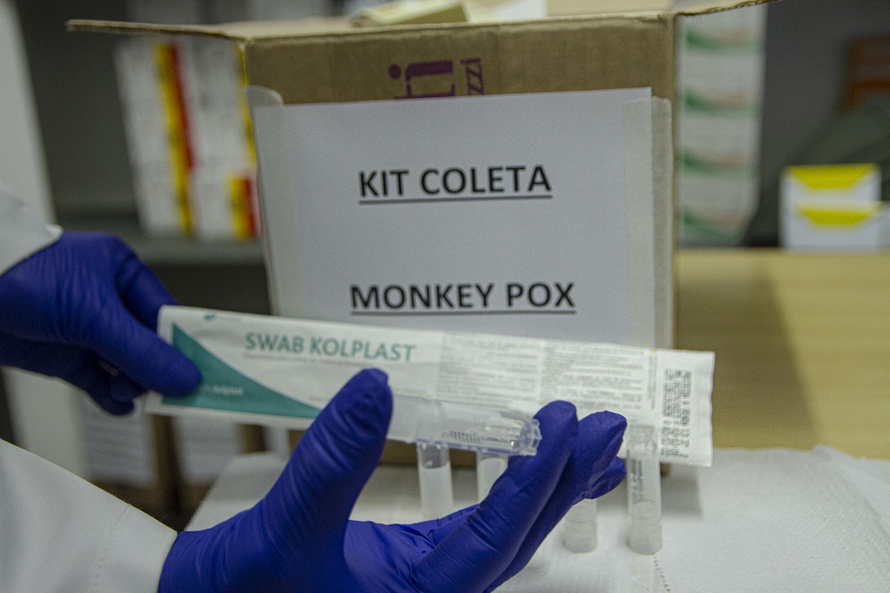 Anvisa autoriza primeiro teste para diagnóstico de varíola dos macacos
