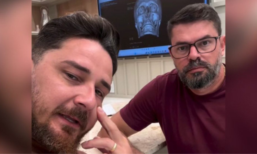 Turista agredido em Porto de Galinhas passa por cirurgia para corrigir quatro fraturas no rosto