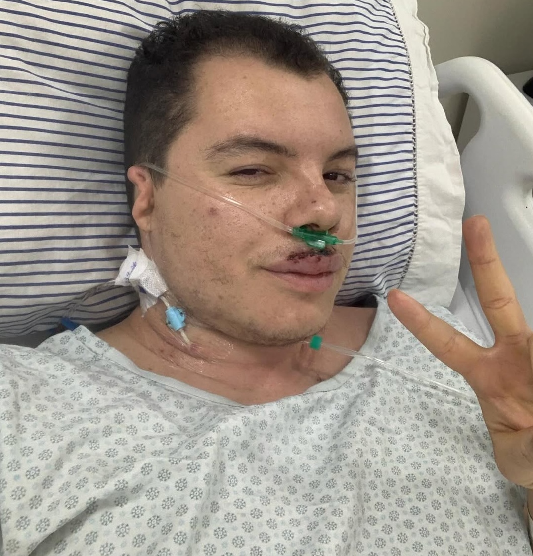 Jogos universitários acabam em agressão e risco de incêndio no interior de São Paulo 