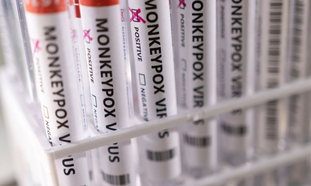 Ministério da Saúde dobra número de laboratórios aptos para realizarem testes de varíola dos macacos