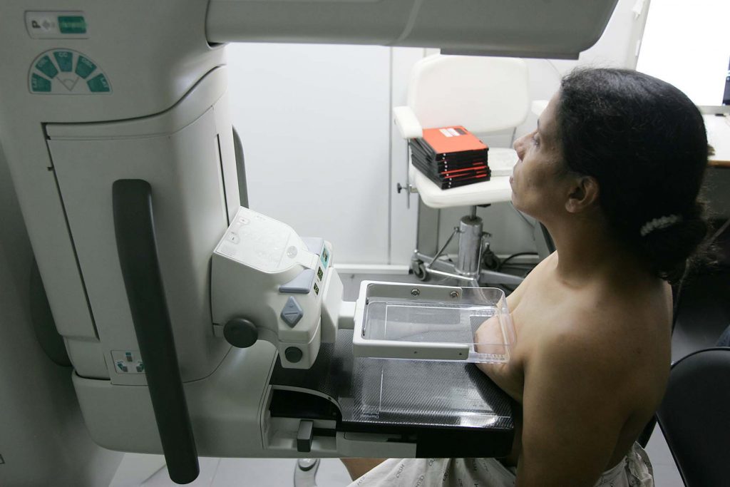 Mamografia só deve ser feita antes ou quatro semanas após a 2ª dose da vacina contra a Covid-19