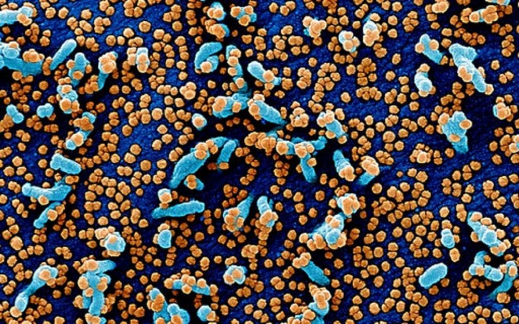 Coronavírus: Cientistas descobrem nova variante que já se espalhou por vários estados brasileiros