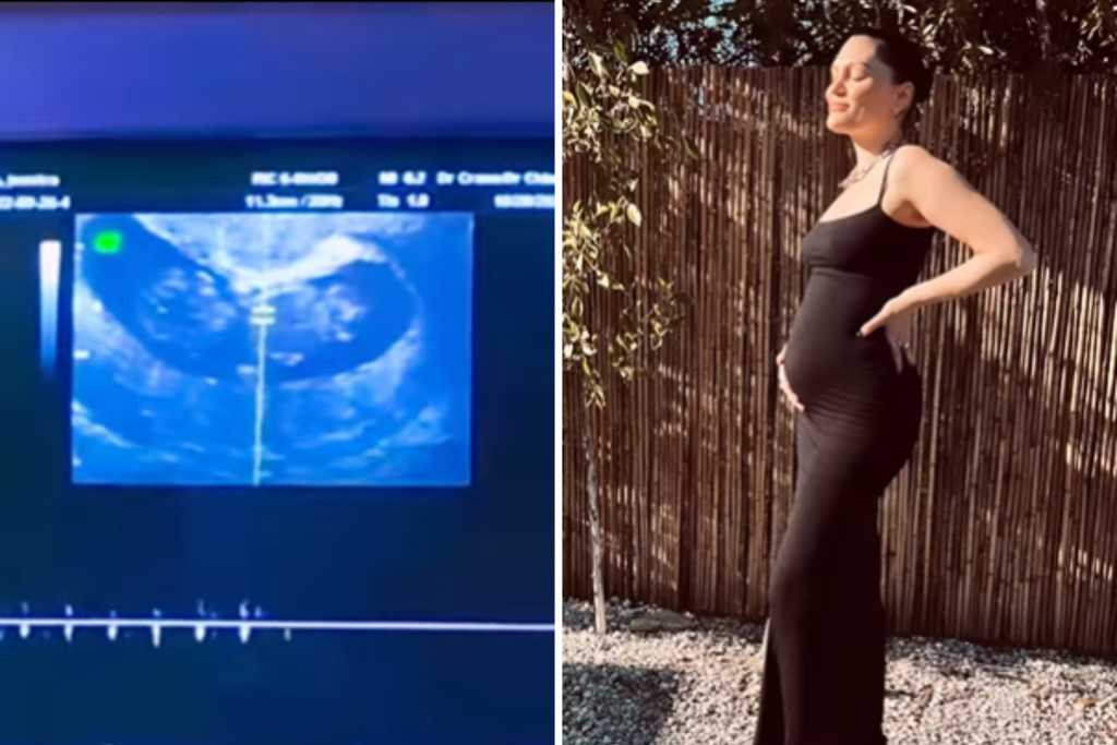 Jessie J anuncia gravidez: ‘Feliz e aterrorizada de finalmente compartilhar’