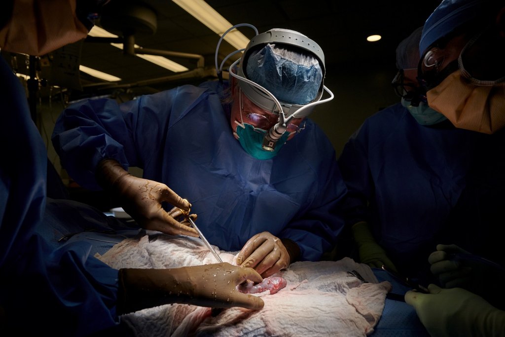 Médicos dos EUA testam com sucesso transplante de rim de porco em corpo humano