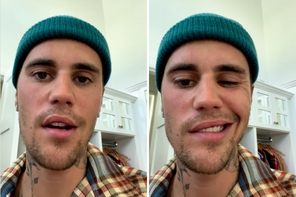 Após cancelar shows, Justin Bieber mostra paralisia facial por causa de doença