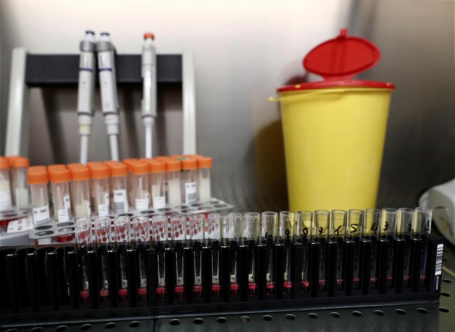 Vacina russa EpiVacCorona contra Covid-19 precisará de reaplicação sazonal