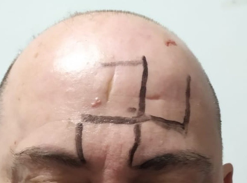 Homem é agredido e tem suástica desenhada na testa em MG