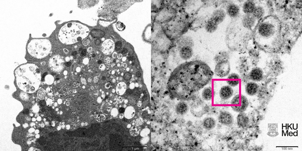 Primeira imagem da variante Ômicron vista por microscópio é divulgada