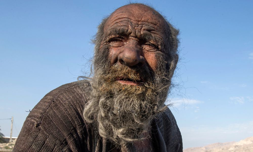 Homem mais sujo do mundo morre no Irã após tomar primeiro banho em mais de meio século