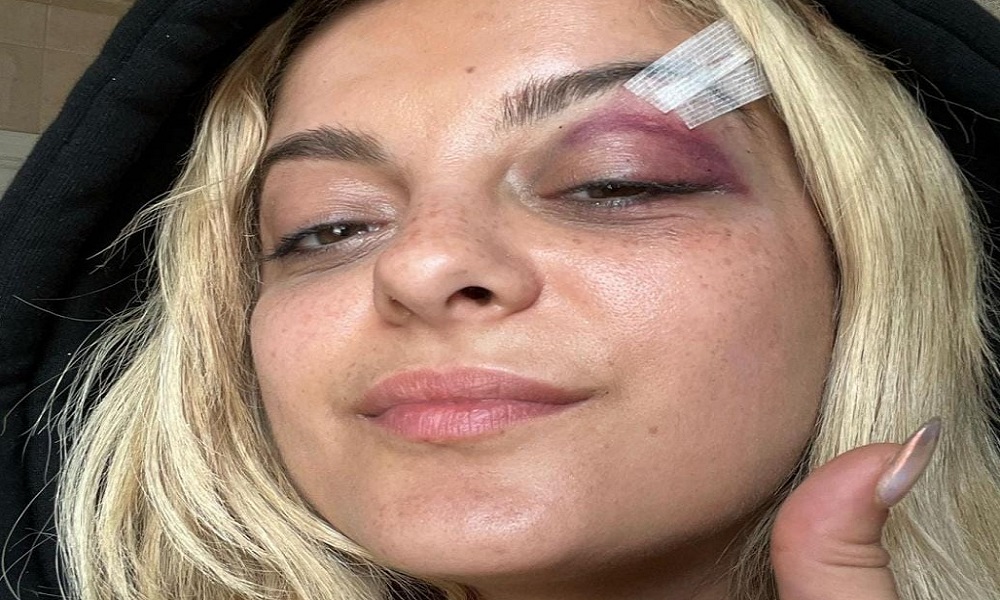 Cantora Bebe Rexha é atingida por celular durante show em Nova York
