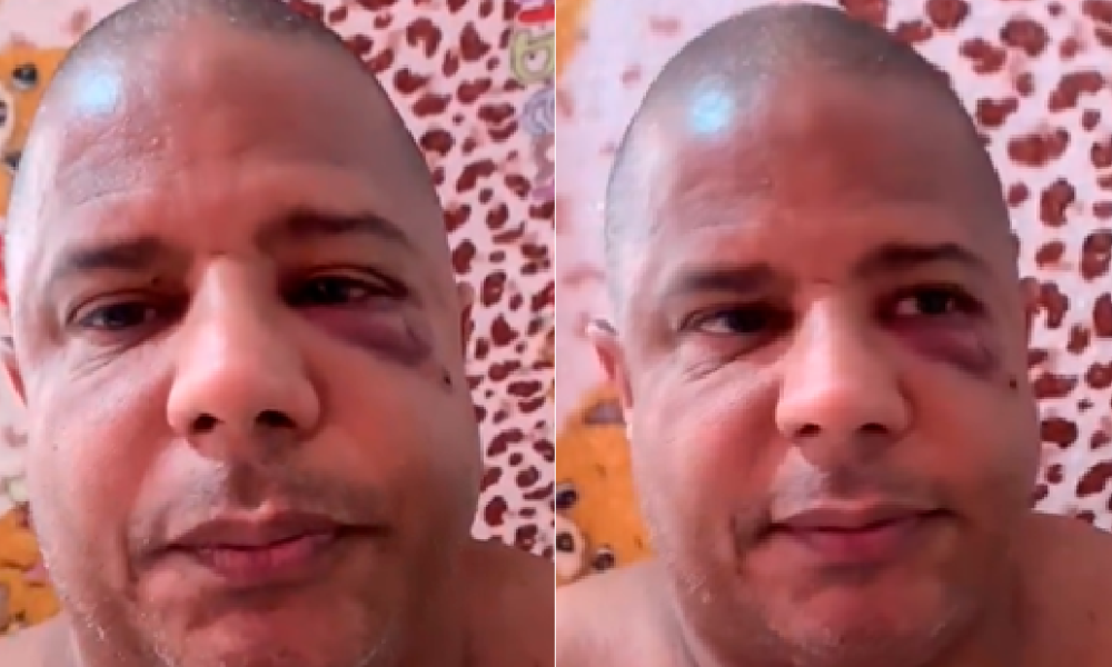 Com sinais de agressão, Marcelinho Carioca aparece em vídeo e confirma sequestro
